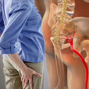testimonianze-sciatalgia